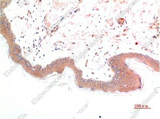 Иммуногистохимия, Phospho-SMAD3 (Ser425), ткань кожи человека