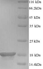 SDS-PAGE