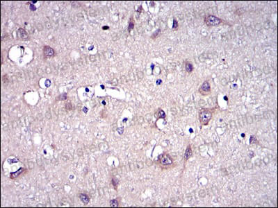 Валидация AntibodySystem RHD06804 (1306)
