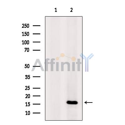 Валидация Affinity DF10170 - 5705