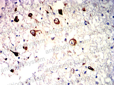 Валидация AntibodySystem RHC20504 (765)