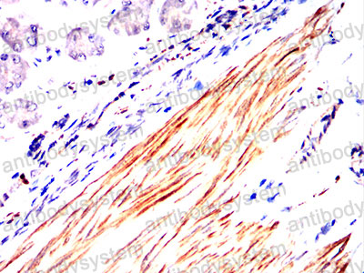 Валидация AntibodySystem RHF52709 (2553)