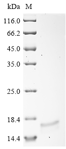 SDS-PAGE