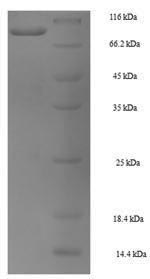 SDS-PAGE
