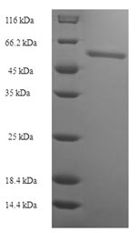 SDS-PAGE