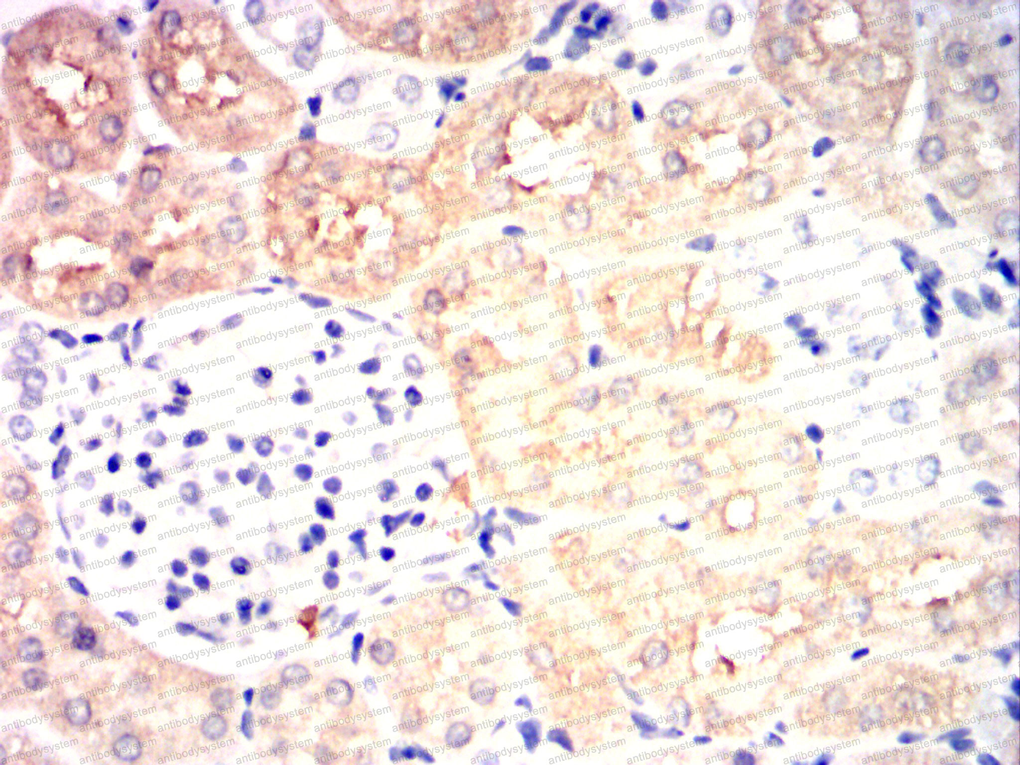 Валидация AntibodySystem RHE94902