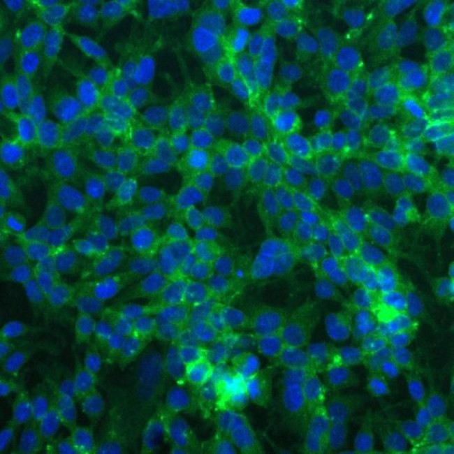 Валидация AssayVector ARM1187(518)