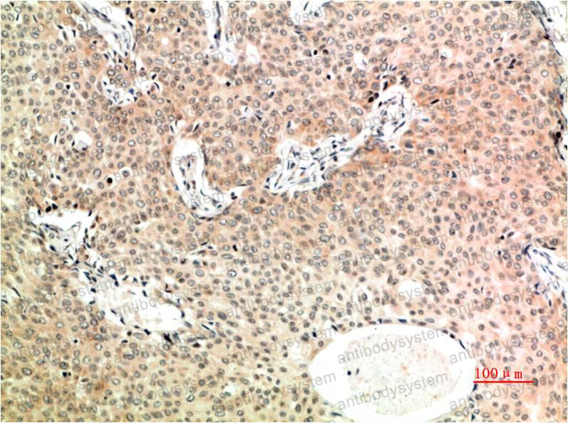 Валидация AntibodySystem RHB91604 (457)