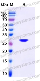 YHD59403, SDS-PAGE