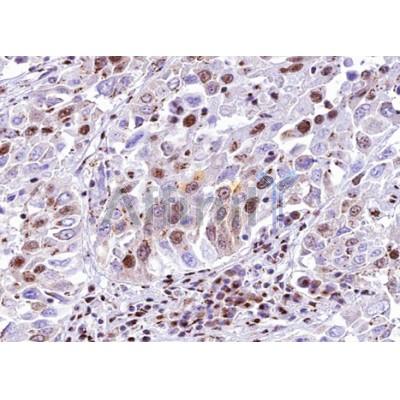 Валидация Affinity AF5160 - 2566