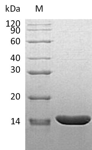 SDS-PAGE