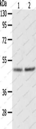Вестерн-блоттинг, AGXT, ткань печени плода человека и клетки HepG2