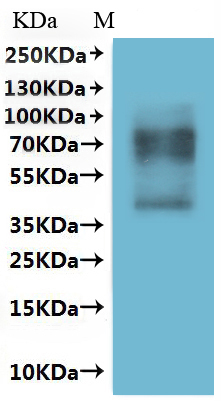 ИФА