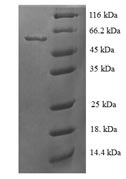 SDS-PAGE
