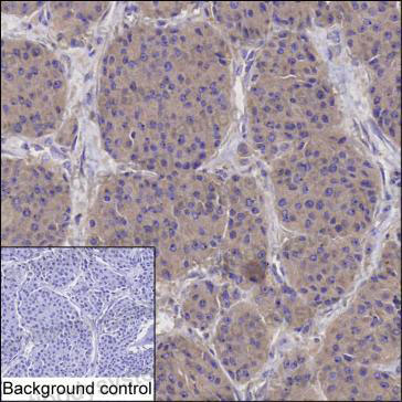 Валидация AntibodySystem RHJ64304