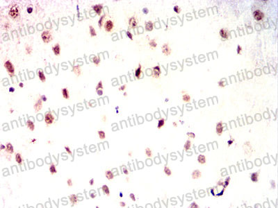 Валидация AntibodySystem RHE73902 (2297)