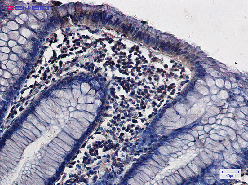 Валидация AssayVector ARM1121(339)
