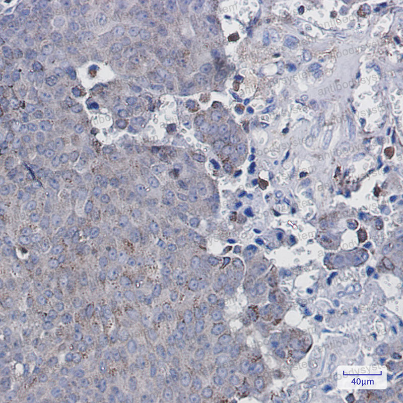 Валидация AntibodySystem RHN70704