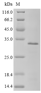 SDS-PAGE