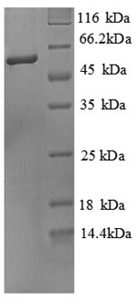 SDS-PAGE