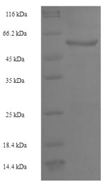 SDS-PAGE