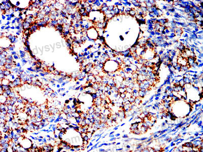 Валидация AntibodySystem RHE23205 (2042)