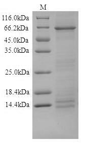 SDS-PAGE