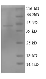 SDS-PAGE