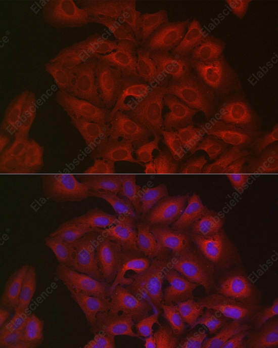 Иммунофлуоресценция, Ubiquitin, клетки U2OS