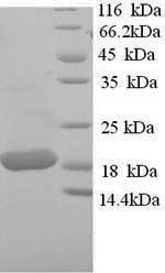 SDS-PAGE