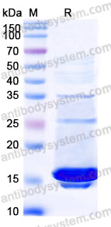YHJ76102, SDS-PAGE