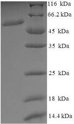 SDS-PAGE