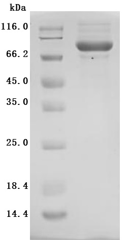 SDS-PAGE
