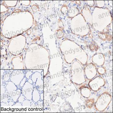 Валидация AntibodySystem RHD18102