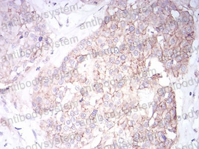 Валидация AntibodySystem RHK41801 (3658)