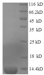 SDS-PAGE