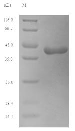 SDS-PAGE