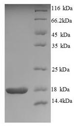 SDS-PAGE