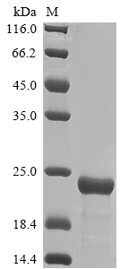 SDS-PAGE