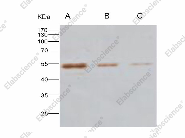 Вестерн-блоттинг, MERS-CoV Nucleoprotein, рекомбинантный белок
