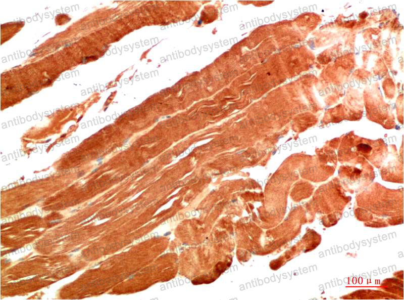 Валидация AntibodySystem RHG84501 (3089)