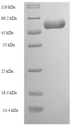 SDS-PAGE