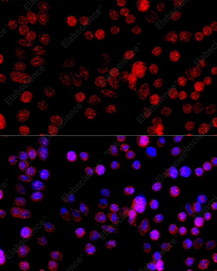 Иммунофлуоресценция, CYP1B1, клетки HeLa
