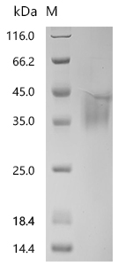 SDS-PAGE