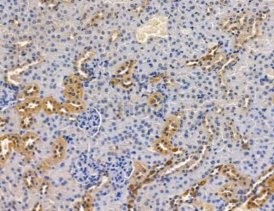 Валидация Affinity DF15949 - 12467