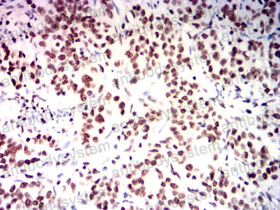 Валидация AntibodySystem RHJ35603 (3386)