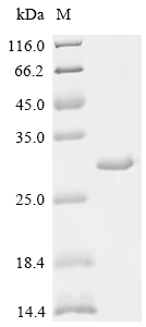 SDS-PAGE