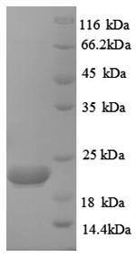 SDS-PAGE