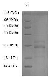 SDS-PAGE