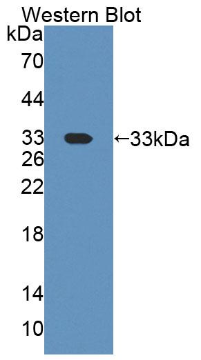 59326